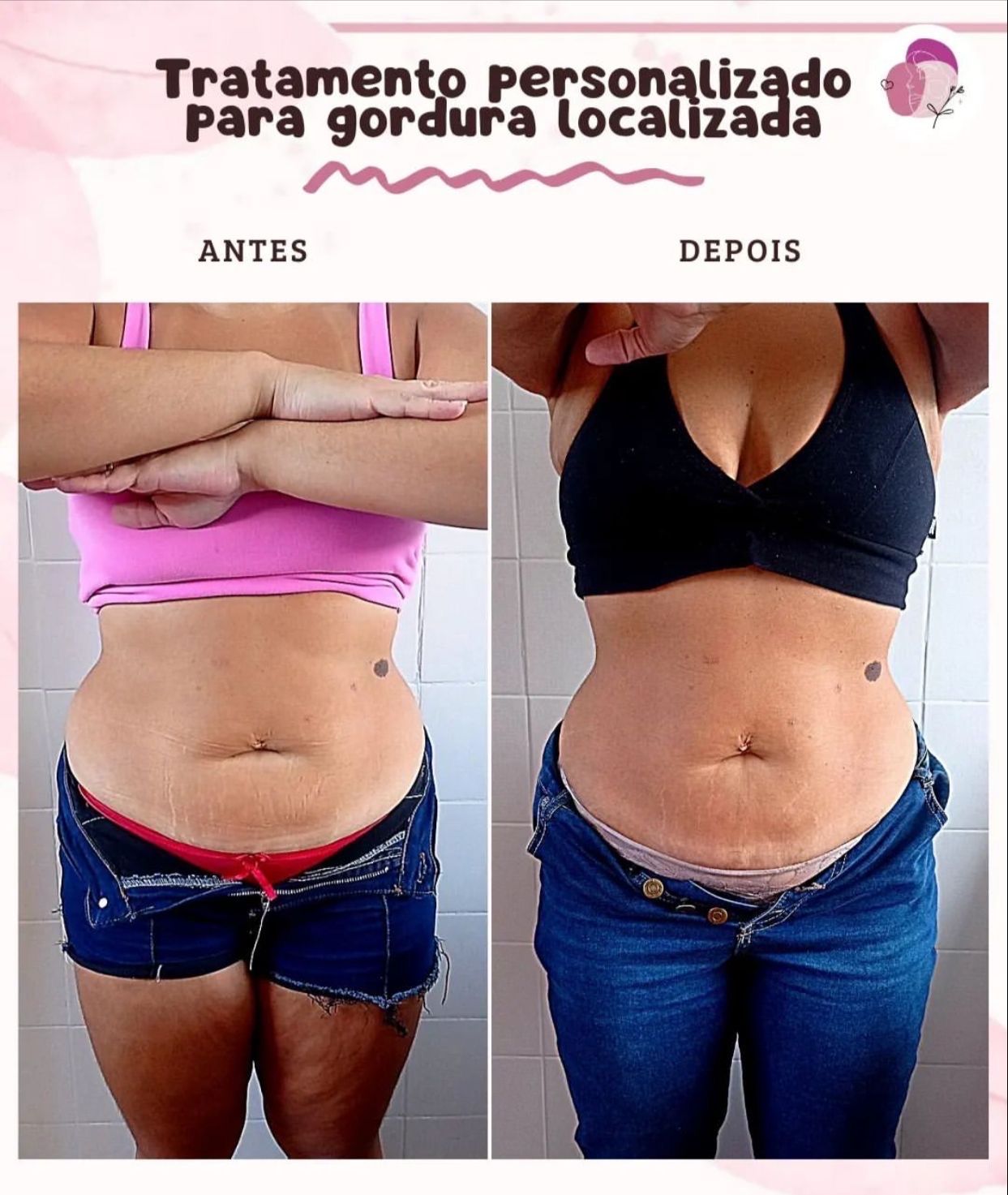 Espaço Anne Gabrielle e Roberta Garrett - Estética e Bem-Estar - Image 6
