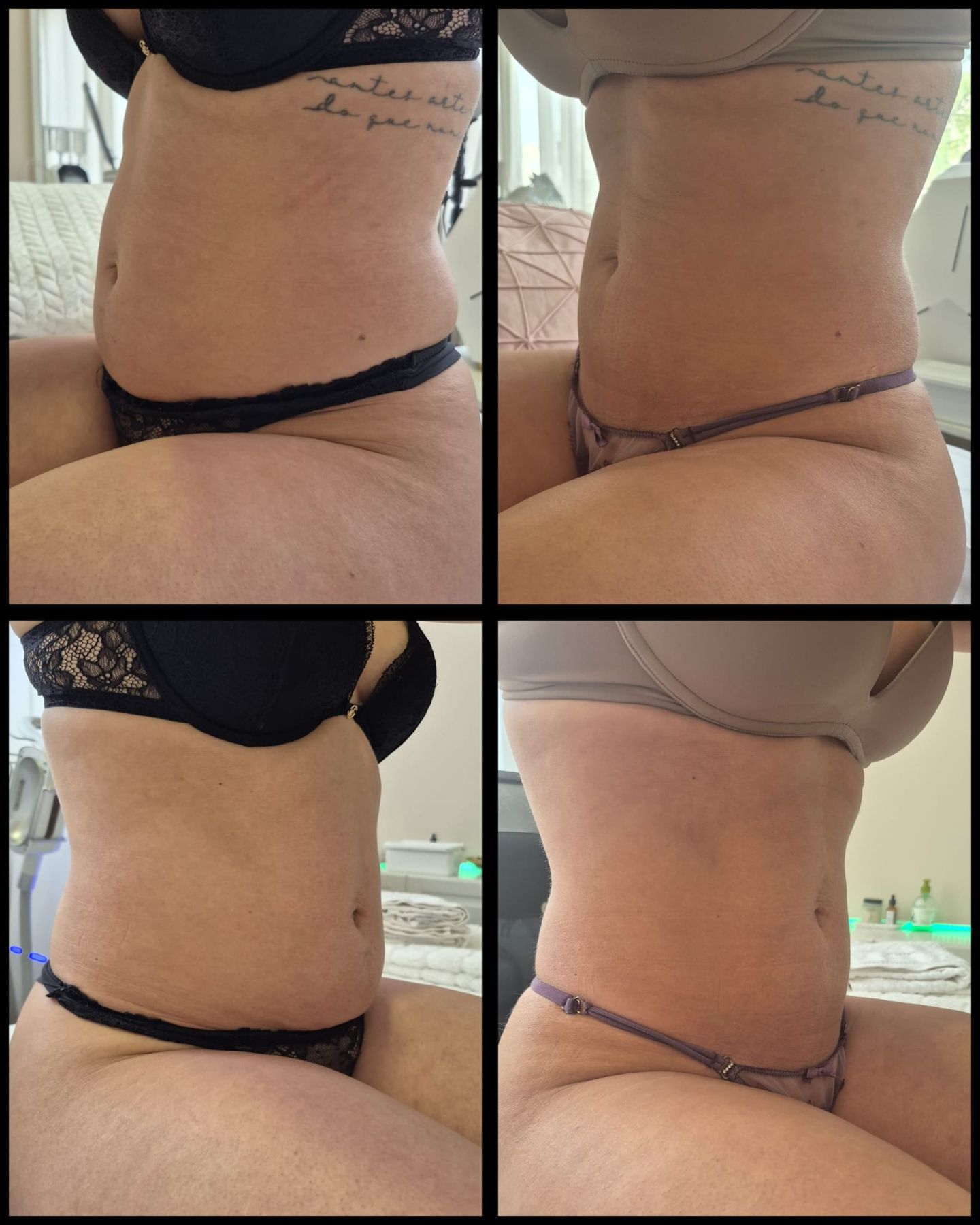 Clinica de Estética Silhuetta - Image 11