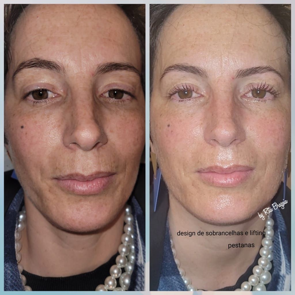Rita Bragaia Estética Facial PMU - Ao Domicílio - Image 2