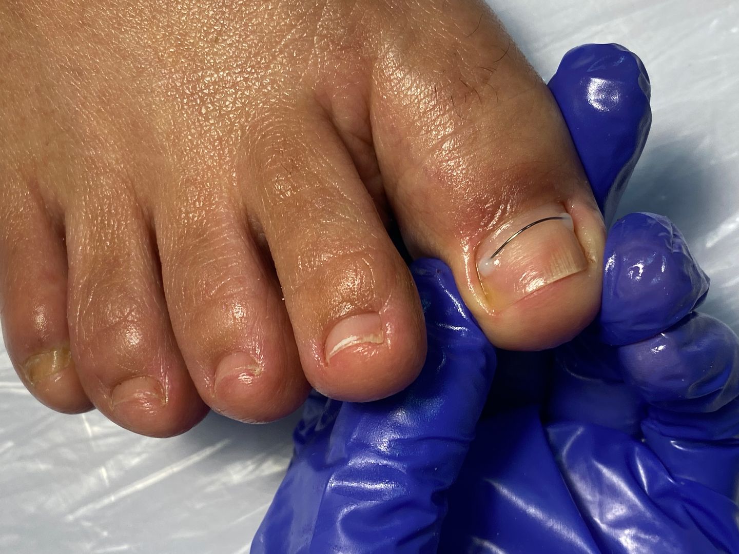 Carol Machado Pedicure Profissional - Image 8