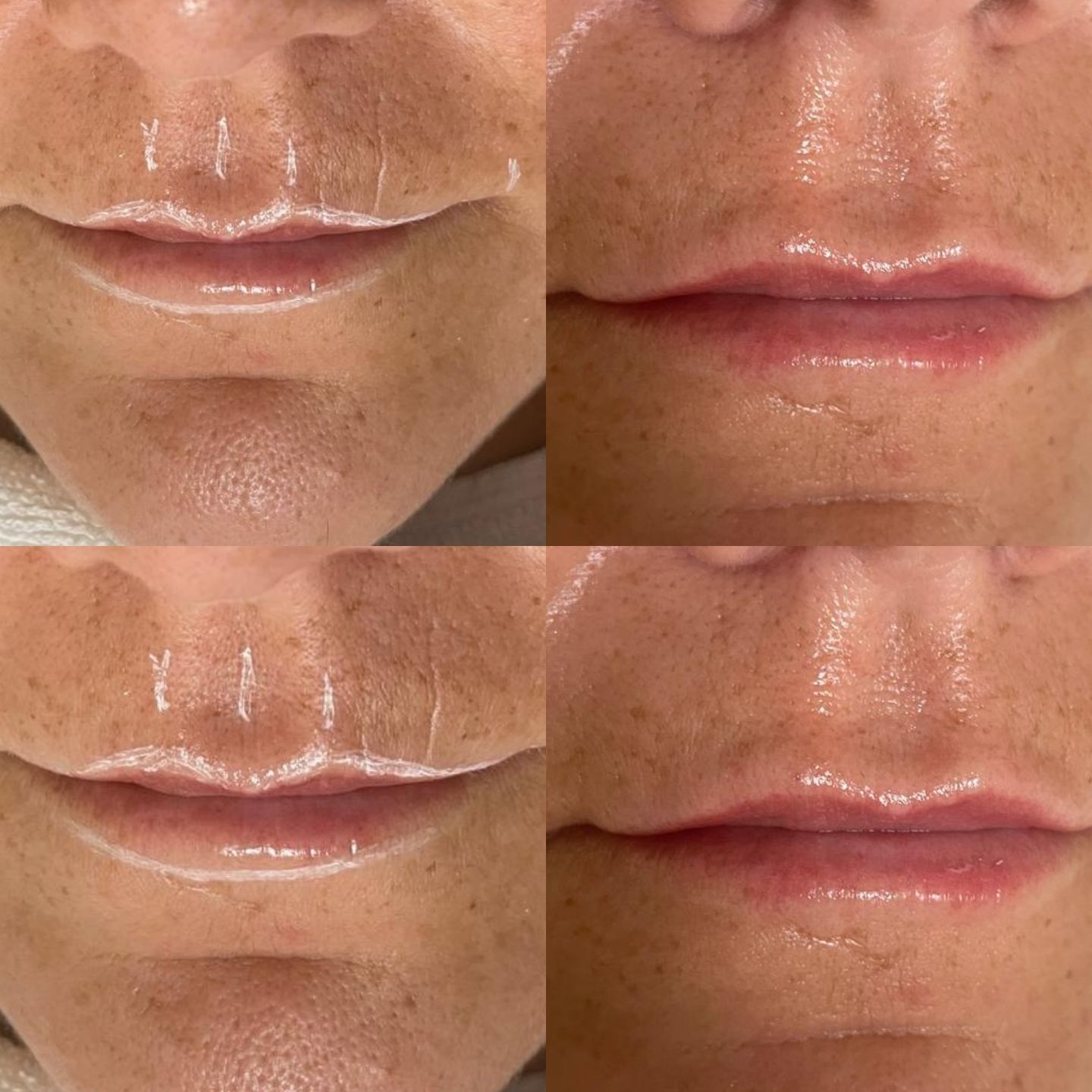 Myself Clinic - Estética Avançada & Integrada - Image 49