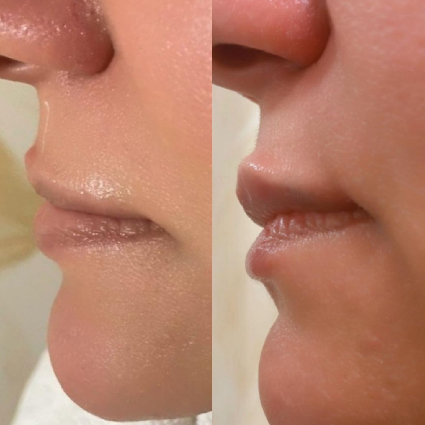 Myself Clinic - Estética Avançada & Integrada - Image 54