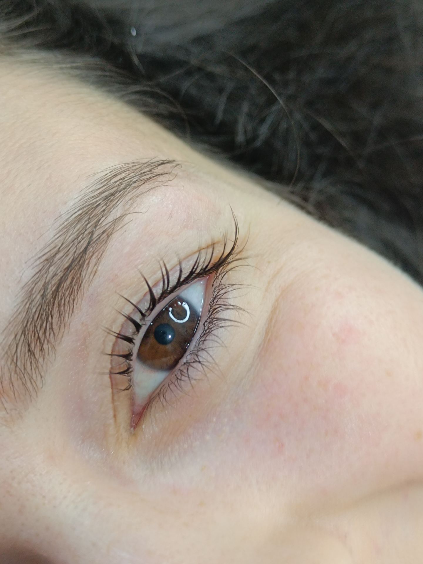 Zeni Alves Estética - Image 16