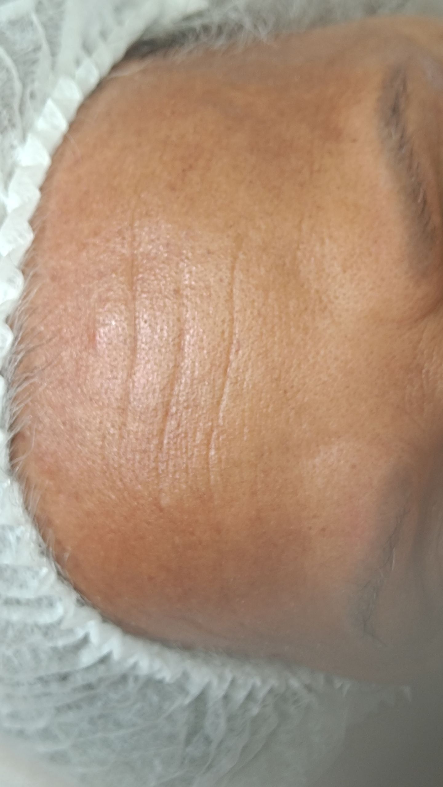 Zeni Alves Estética - Image 35