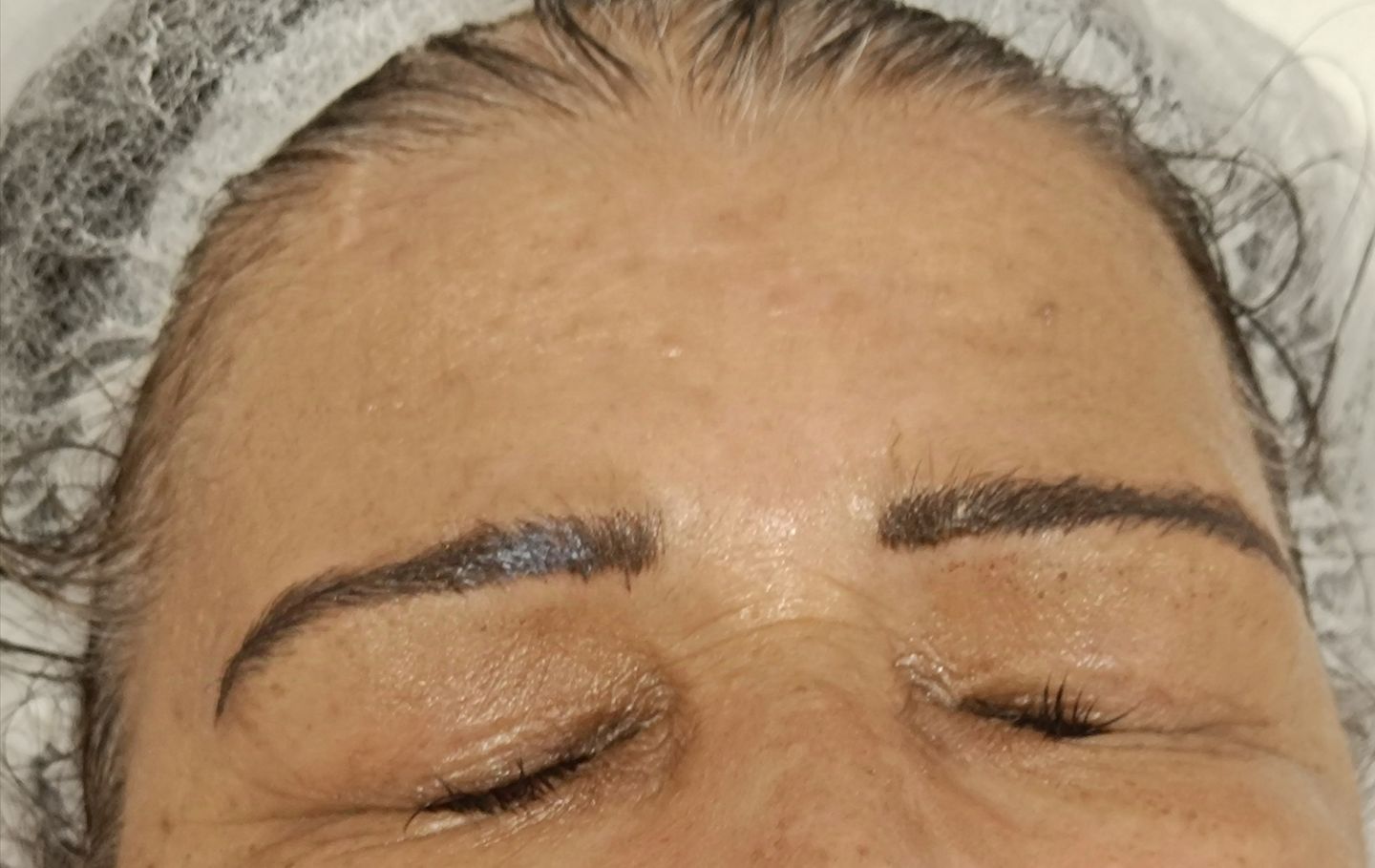 Zeni Alves Estética - Image 11