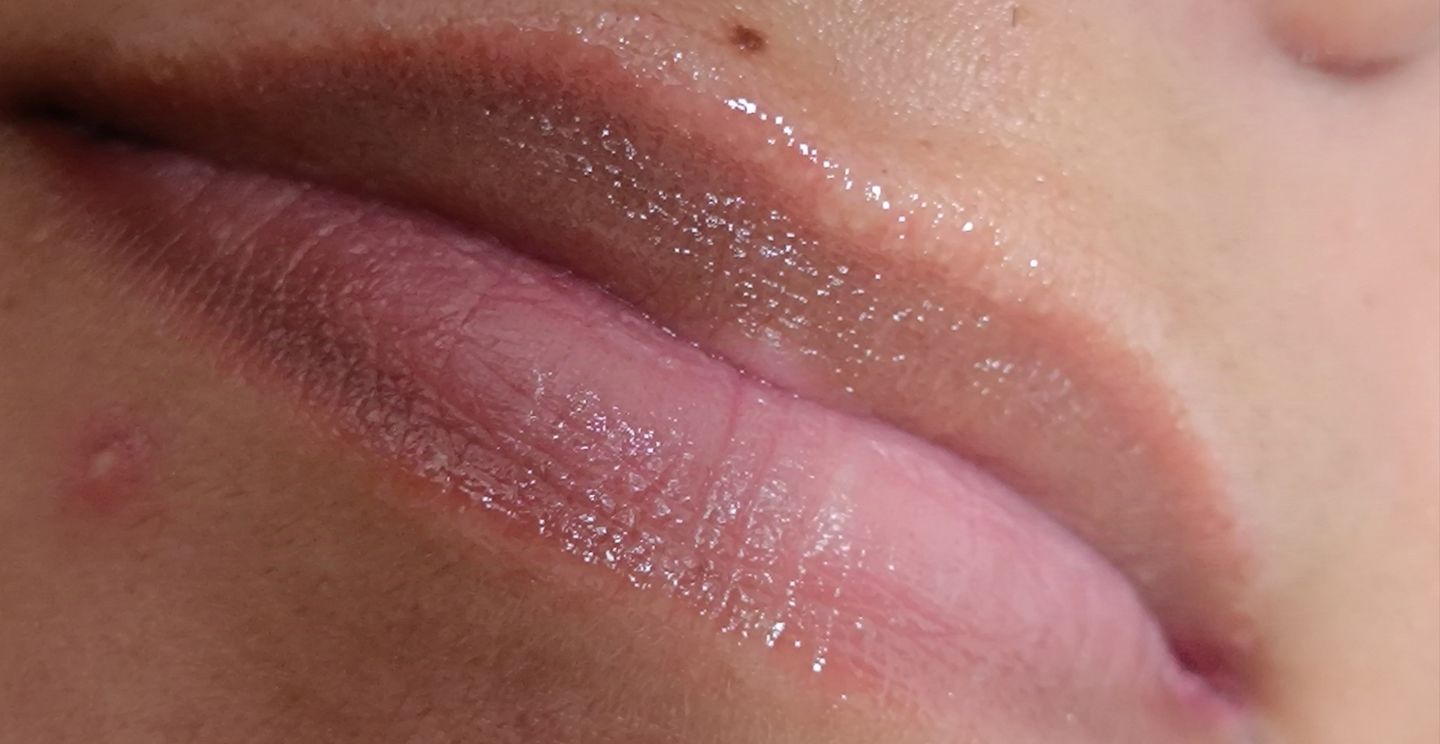 Zeni Alves Estética - Image 7