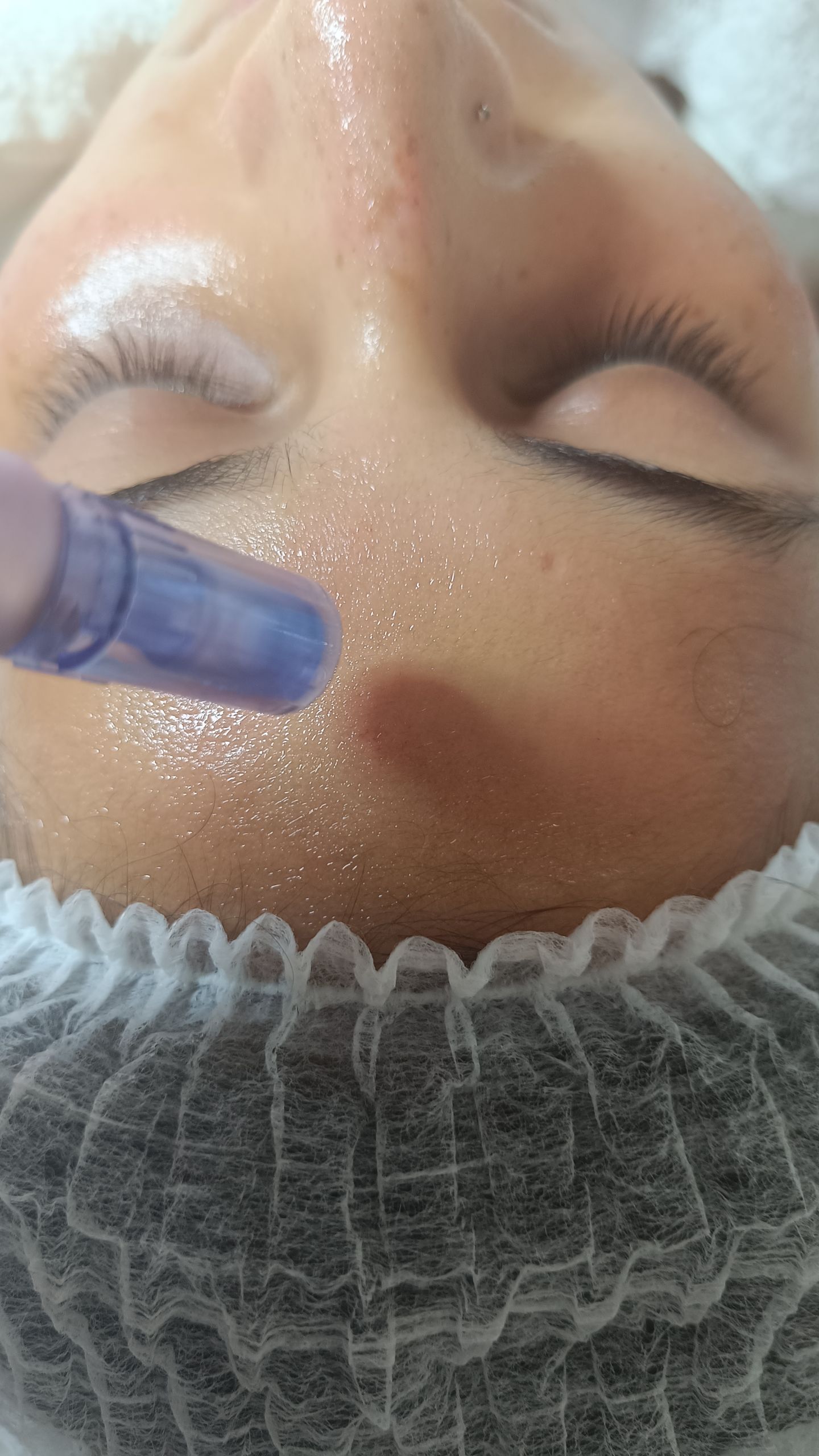 Zeni Alves Estética - Image 30