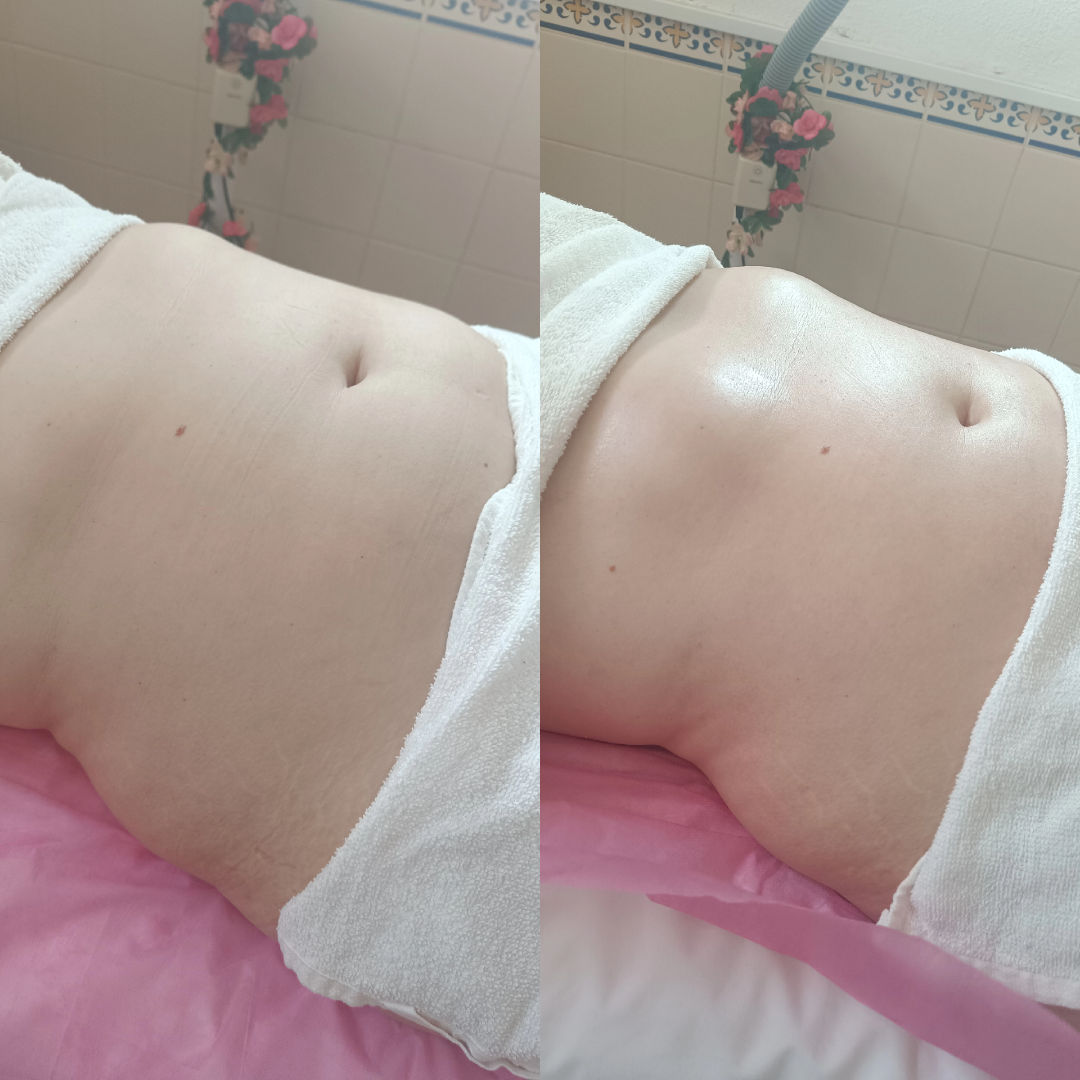 Zeni Alves Estética - Image 36