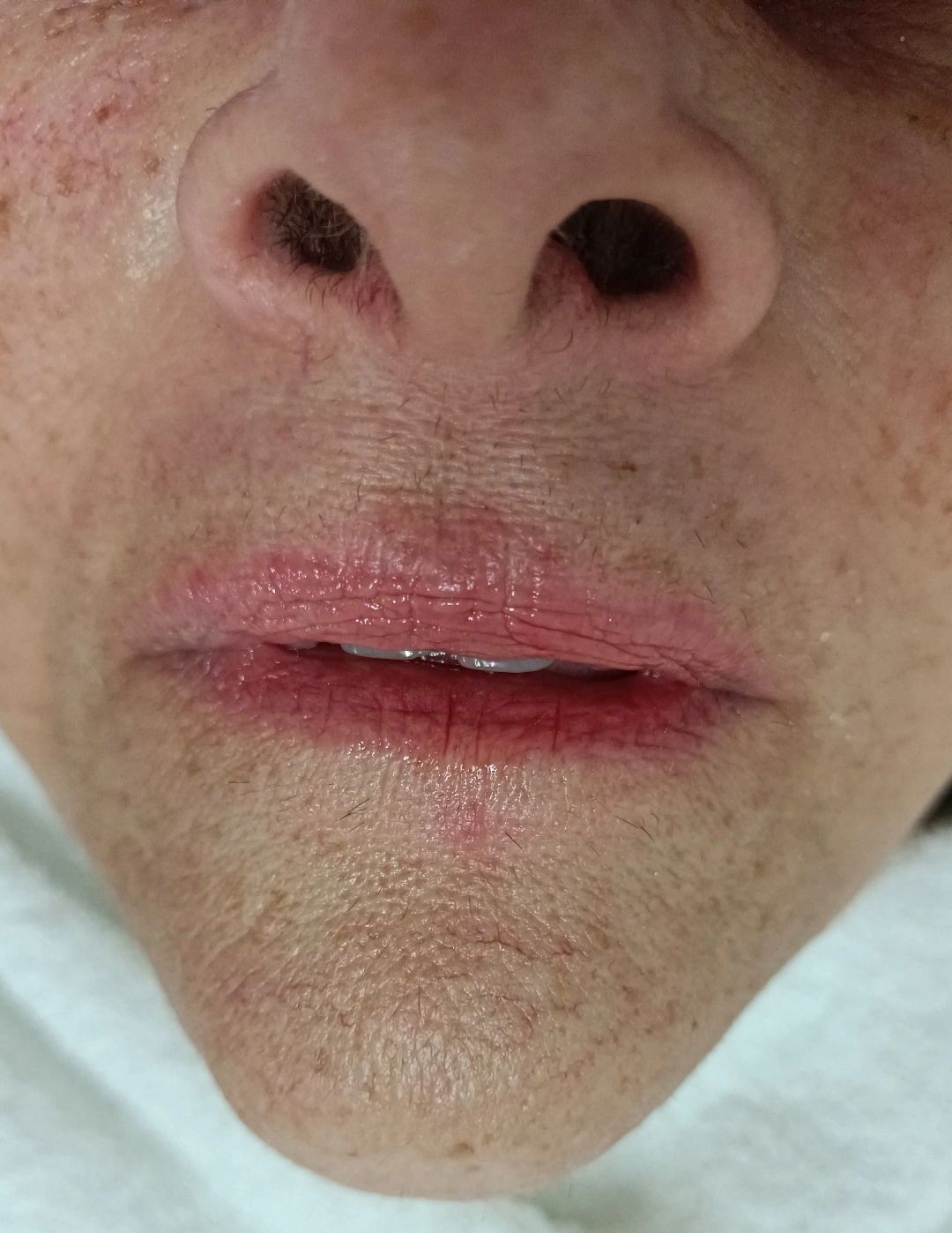 Zeni Alves Estética - Image 14