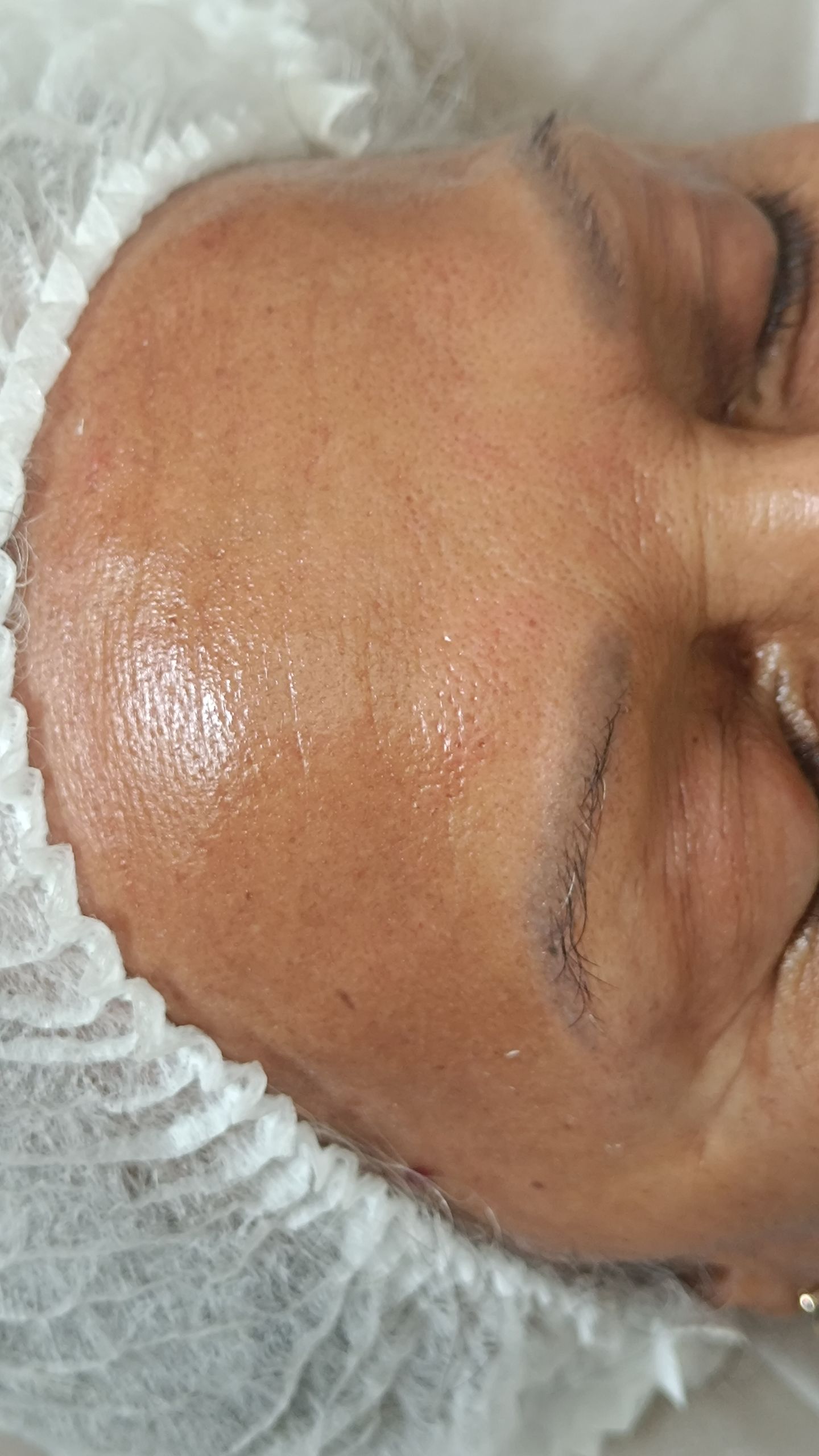 Zeni Alves Estética - Image 37