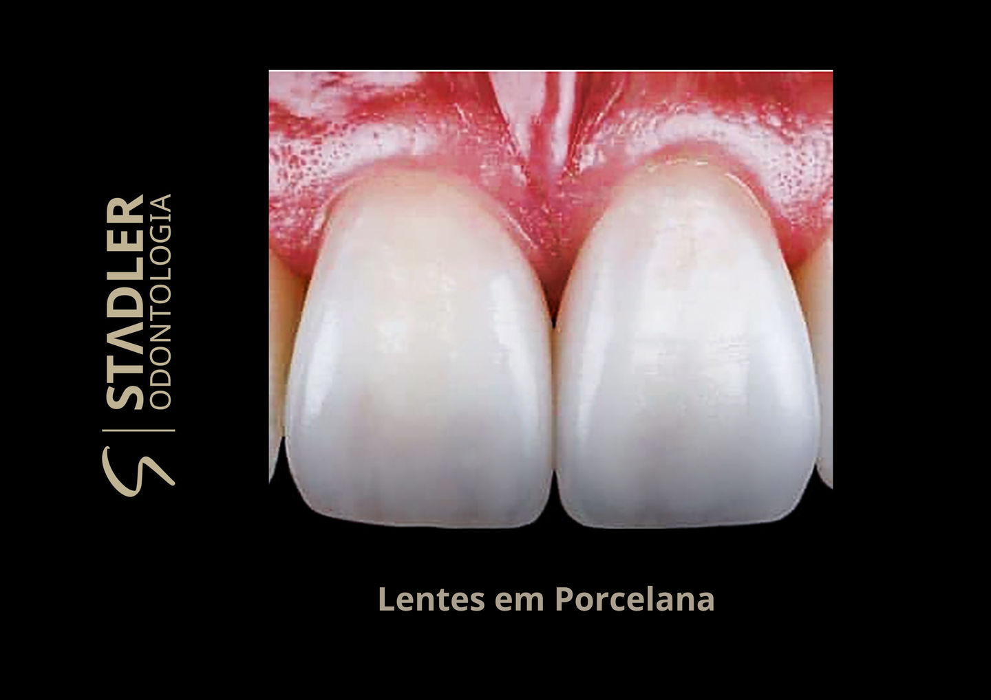 Stadler | Odontologia - Image 8