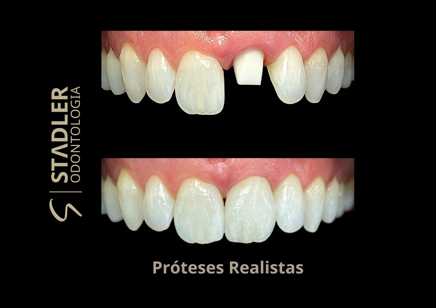 Stadler | Odontologia - Image 4
