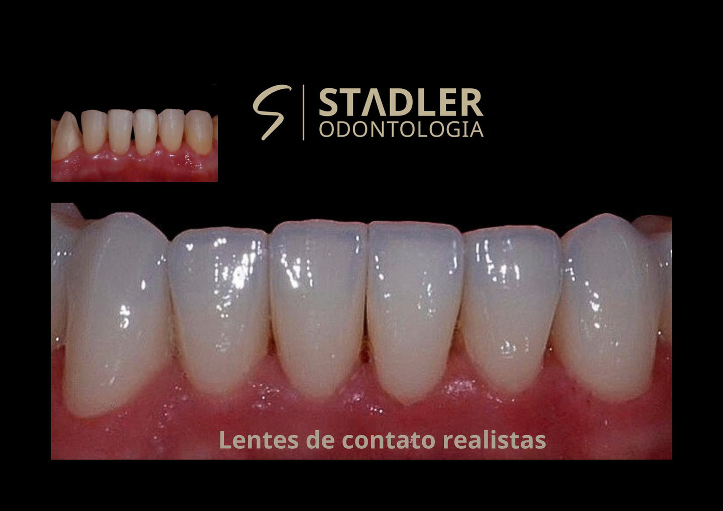 Stadler | Odontologia - Image 6