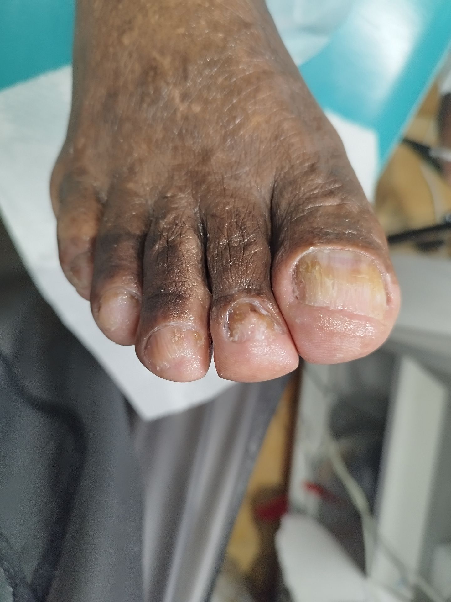 Cleyde Pedicure Medical - Image 16