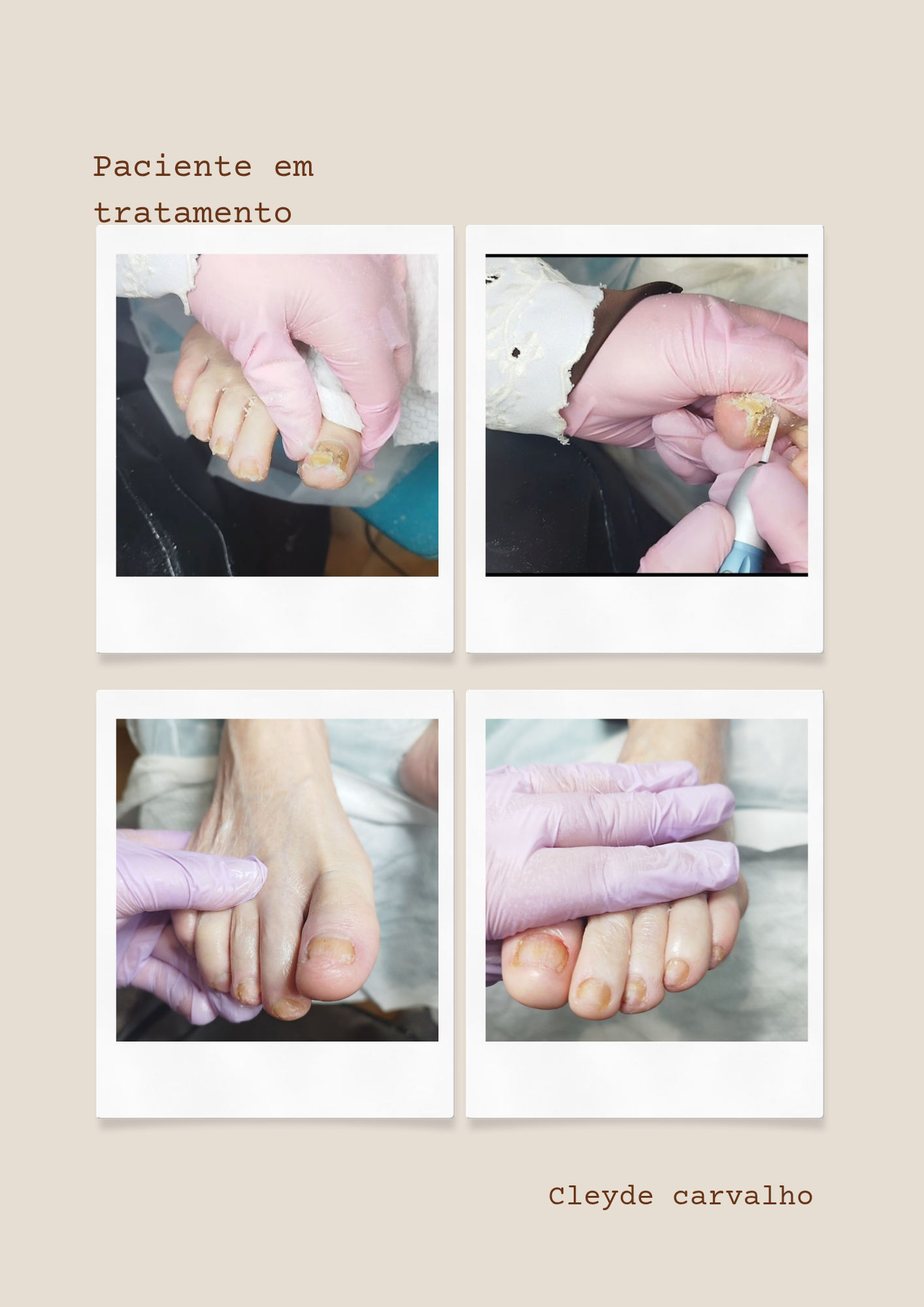 Cleyde Pedicure Medical - Image 8