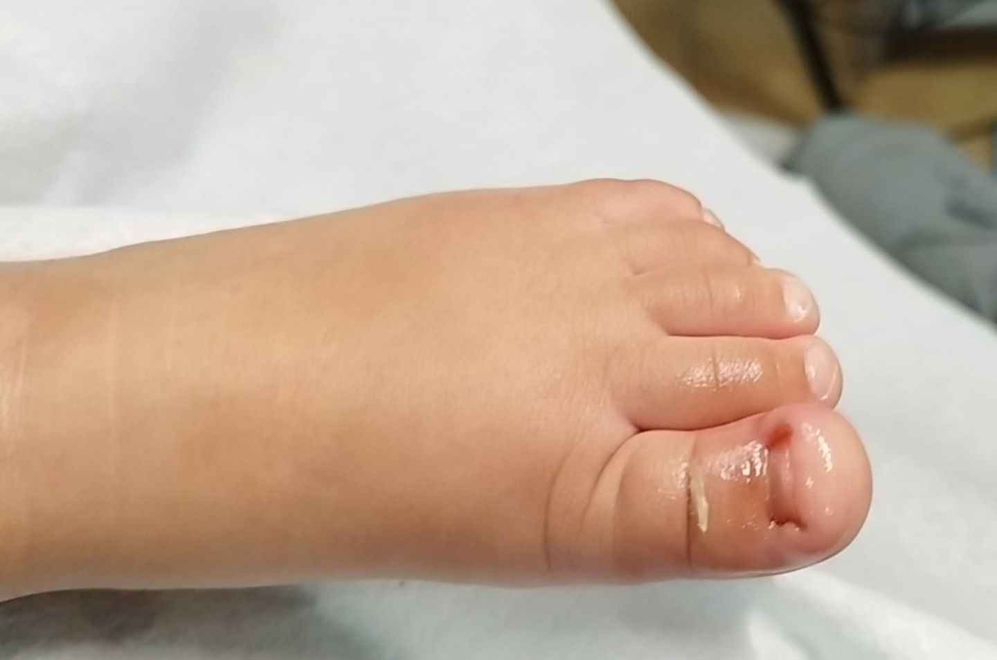 Cleyde Pedicure Medical - Image 14