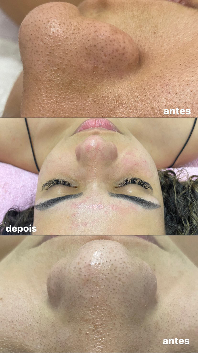 Esteticista Yasmin Costa - Image 3