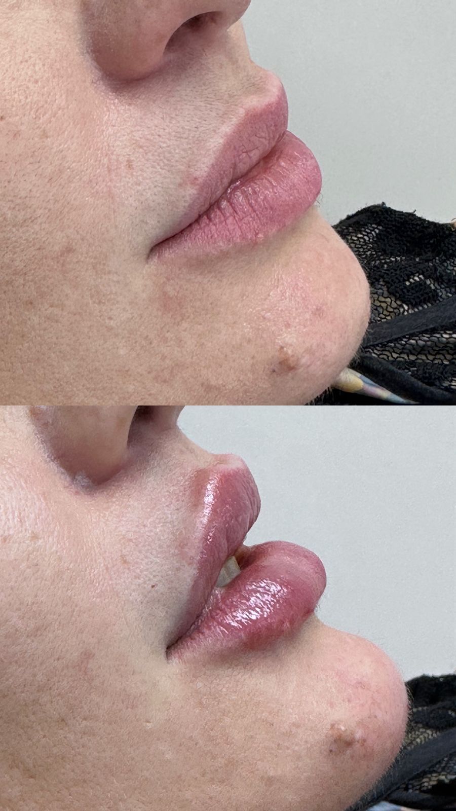 Dra. Verônica Morais | Biomedicina Estética - Image 7