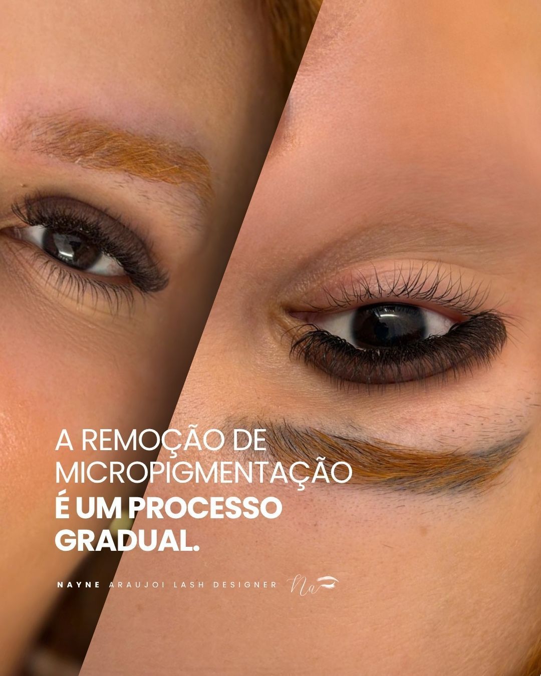 Diamond Beauty Braga - Image 60