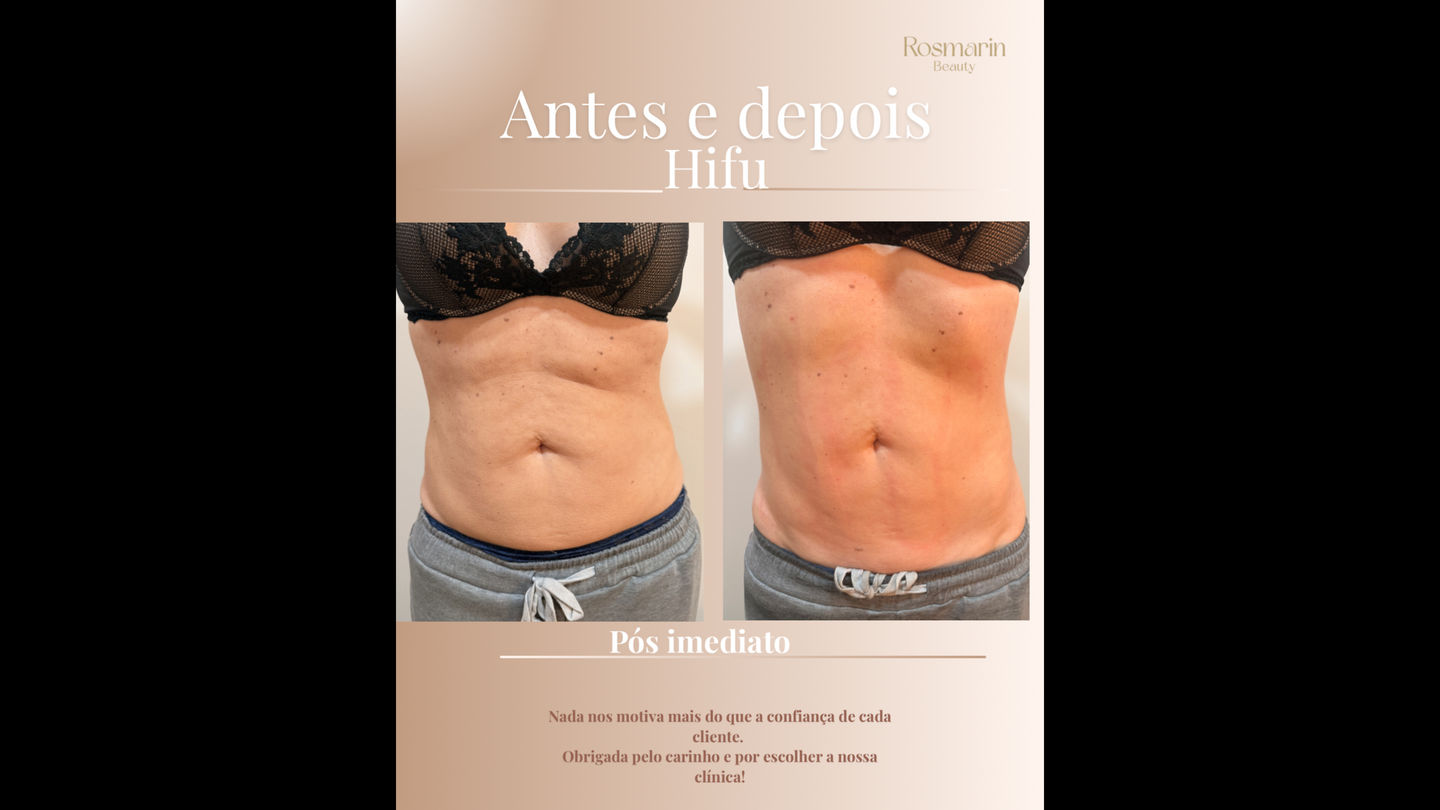Rosmarin Beauty - Image 5