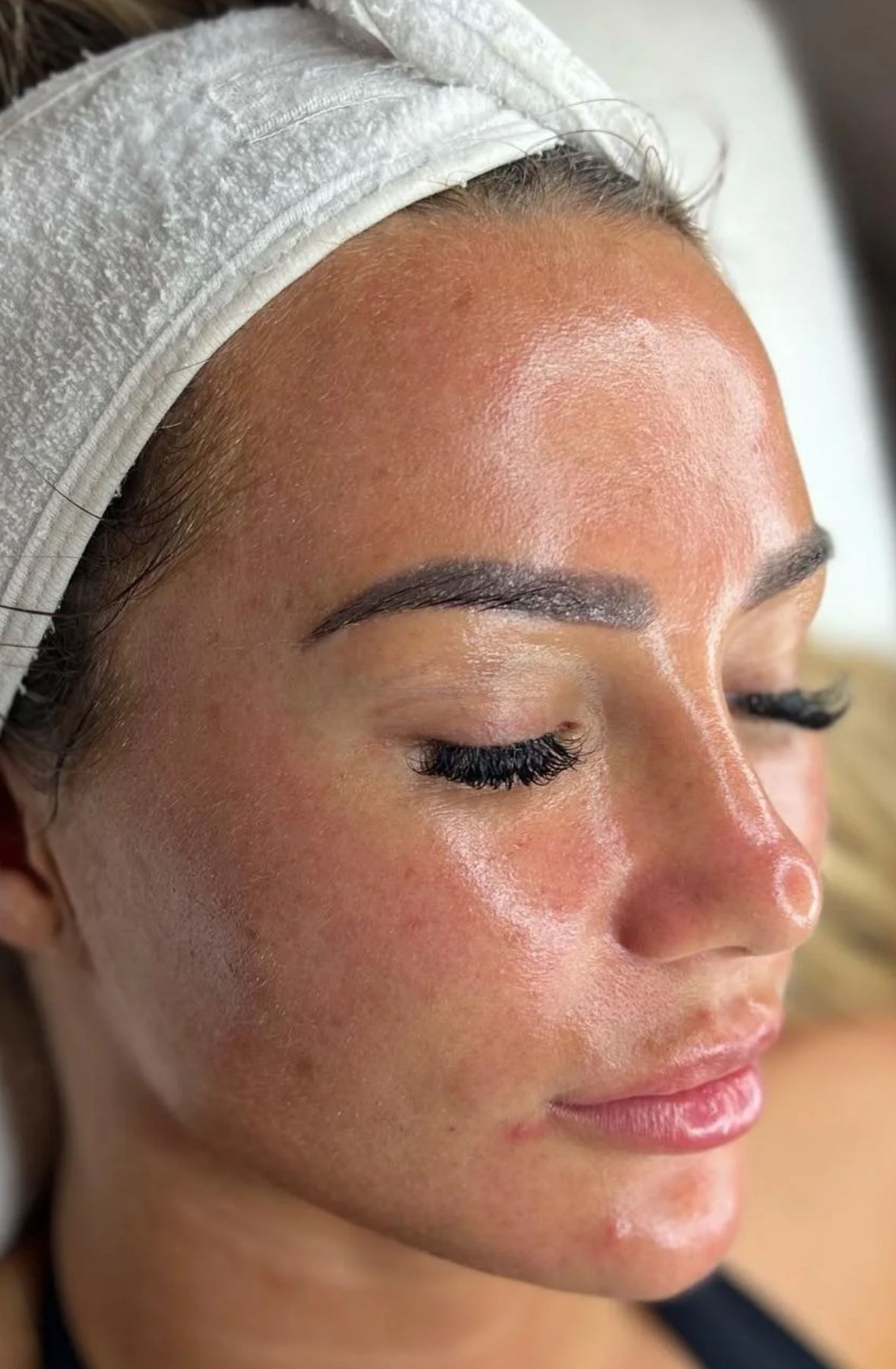 Muse Clínica | Estética Natural - Image 21