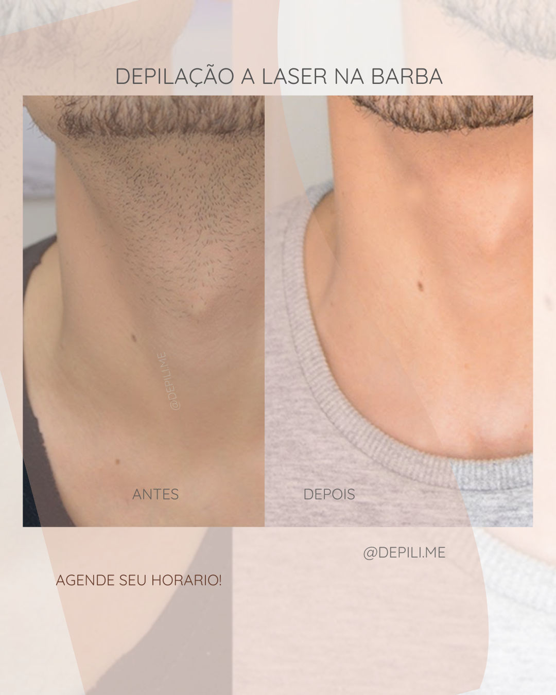 Depili.me - Image 3