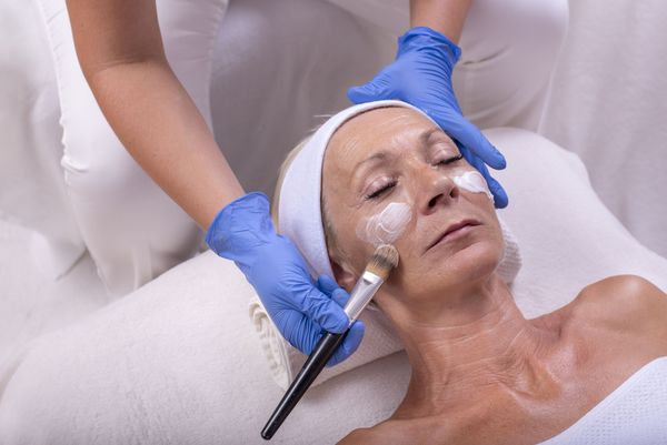Aplicação de Peeling Químico
