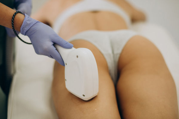 Lipo Laser