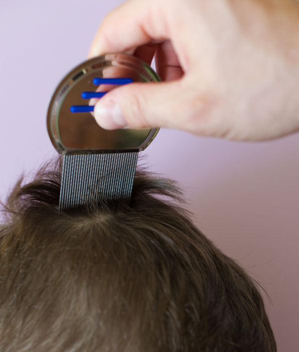 Tratamento de Pediculose + Revisão