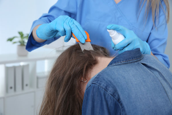 Revisão Extra - Tratamento de Pediculose