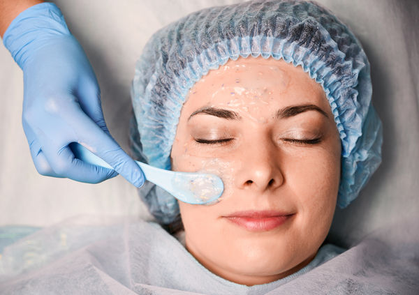 Peeling Retinóico