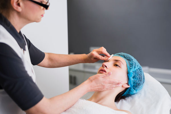 Tratamento para Cicatriz de Acne
