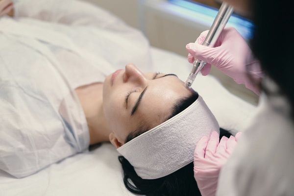 Rejuvenescimento Facial – Jato de Plasma
