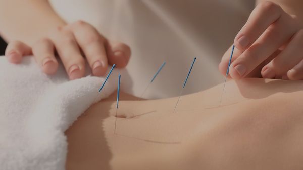 Perda de peso com acupunctura laser