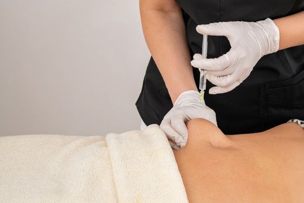 Mesoterapia