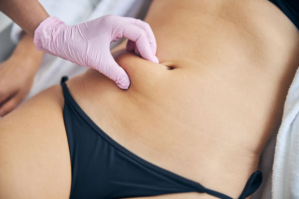 Lipo enzimática