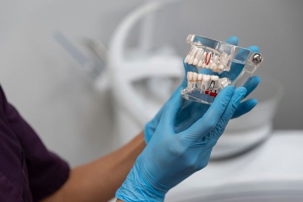 Prótese Dentária Flexível
