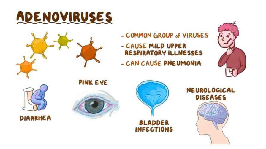 Adenovirus Eye Infection Risk Rises Stay Safe During Monsoon,
Adenovirus sideeffects
