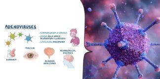 Adenovirus Infection