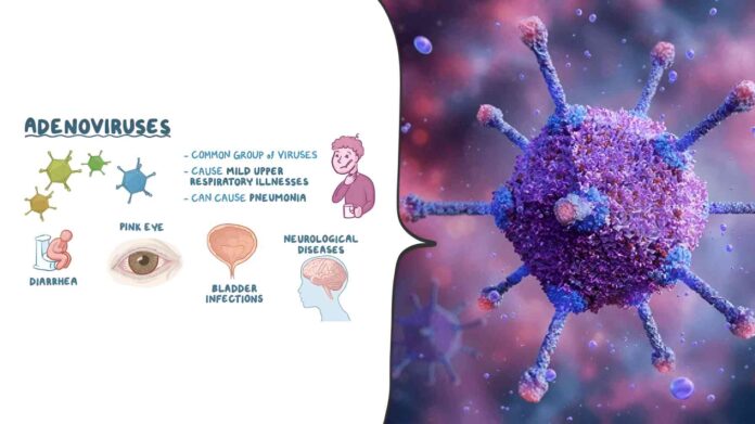 Adenovirus Infection
