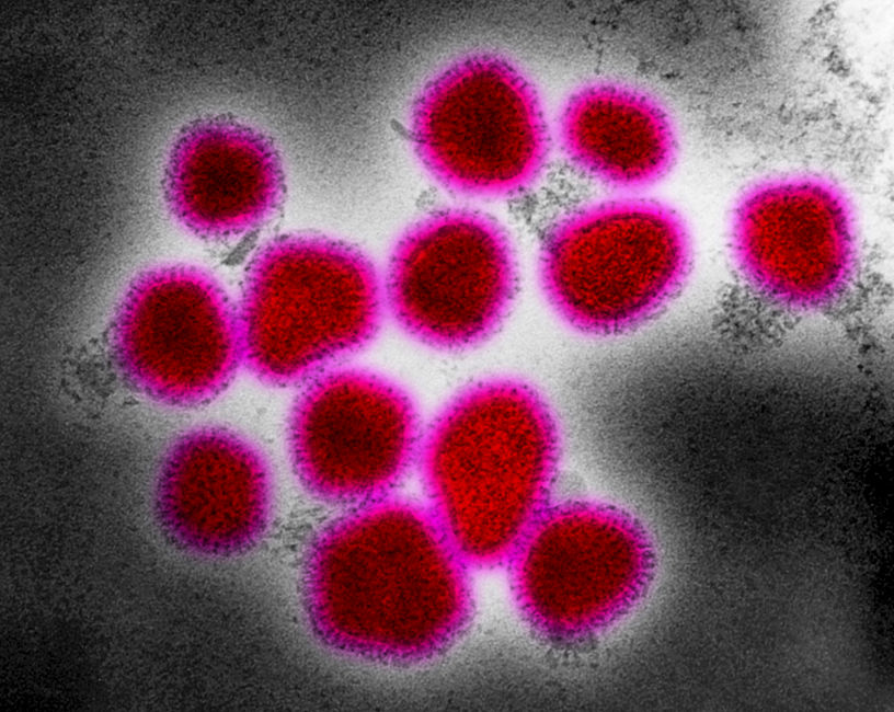 Negatively-stained Hong Kong Flu Virus