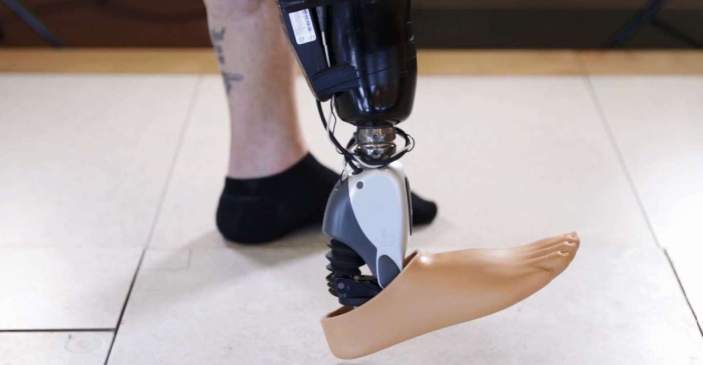 This company builds mind-controlled robotic limbs