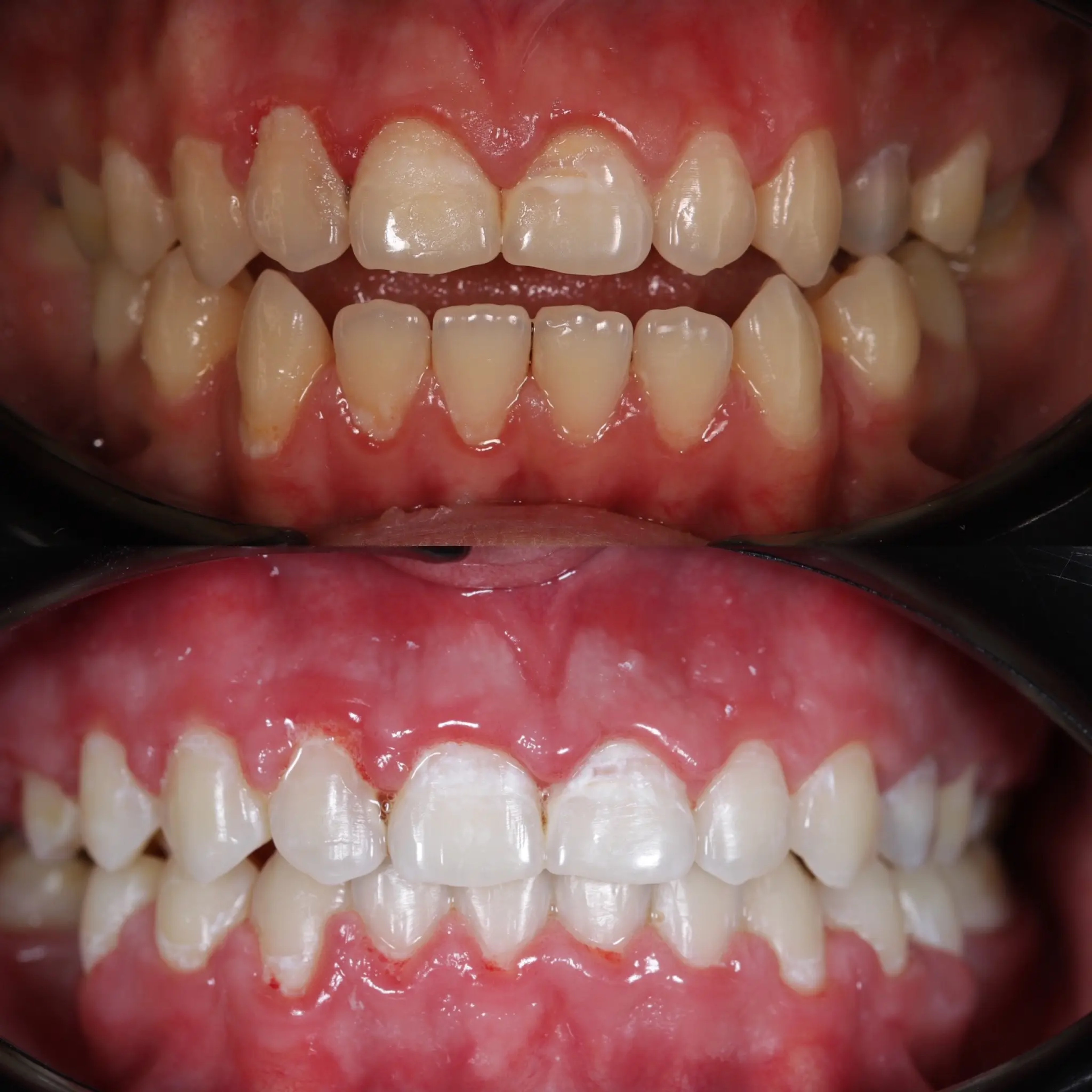 Orthodontics 3