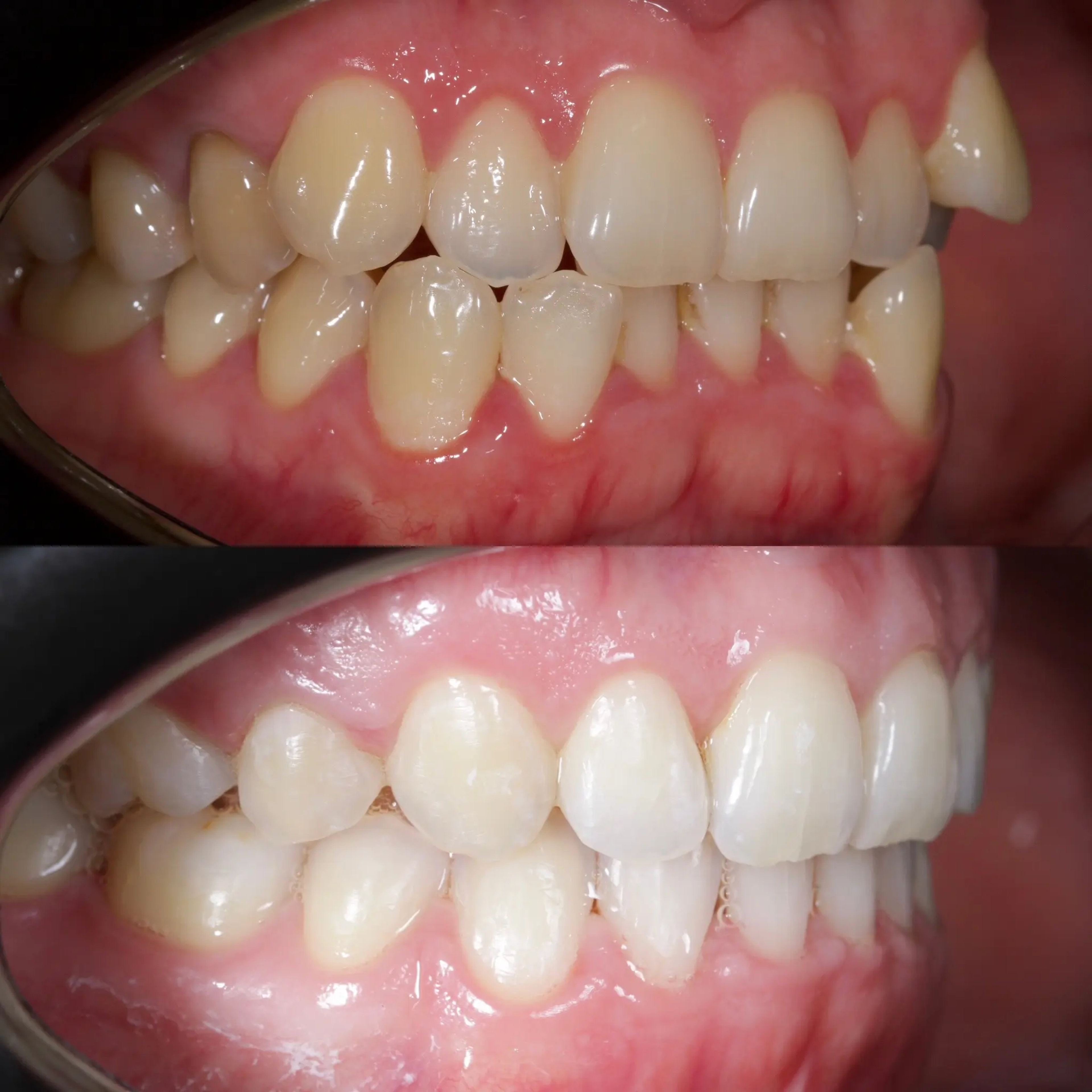 Orthodontics 4