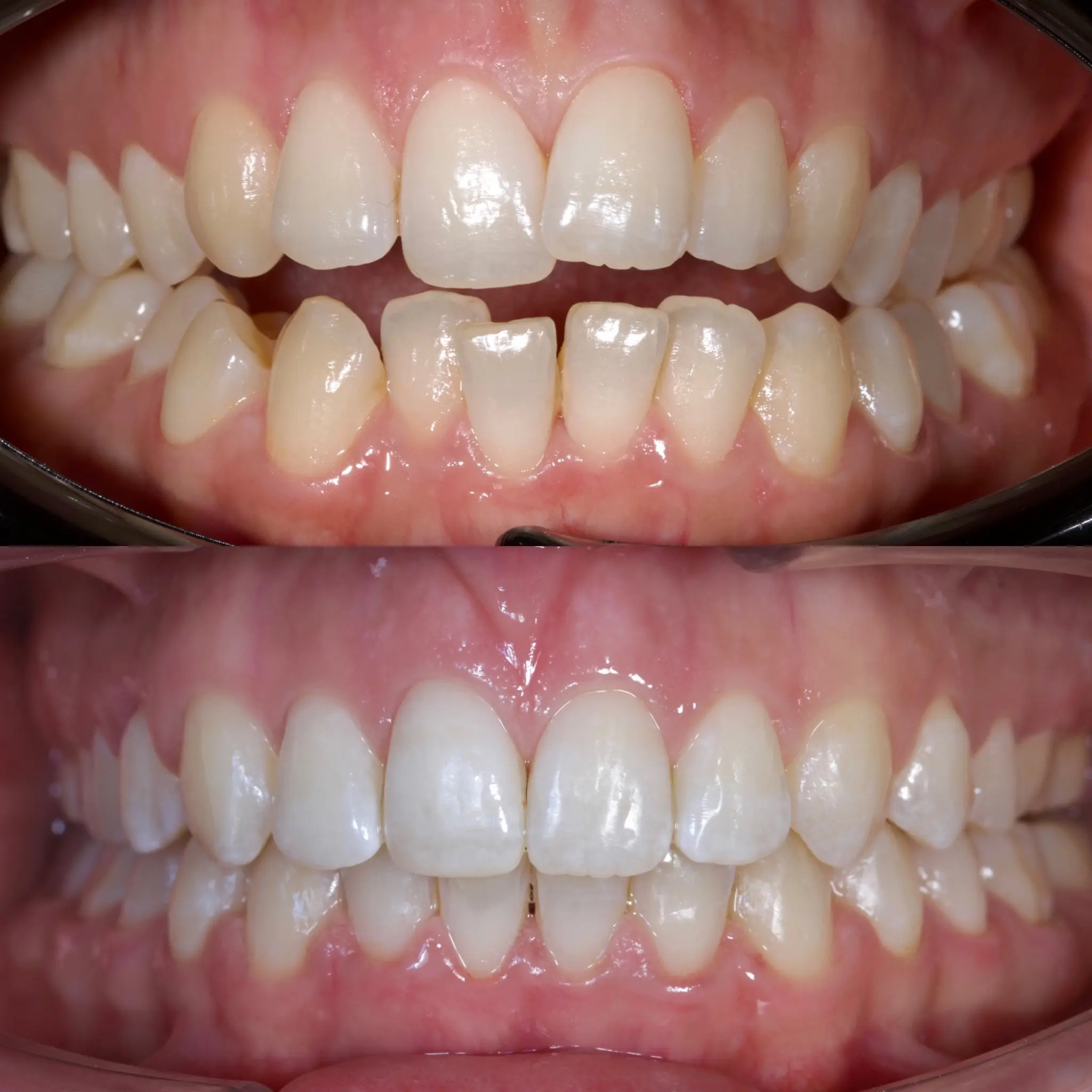 Orthodontics 6