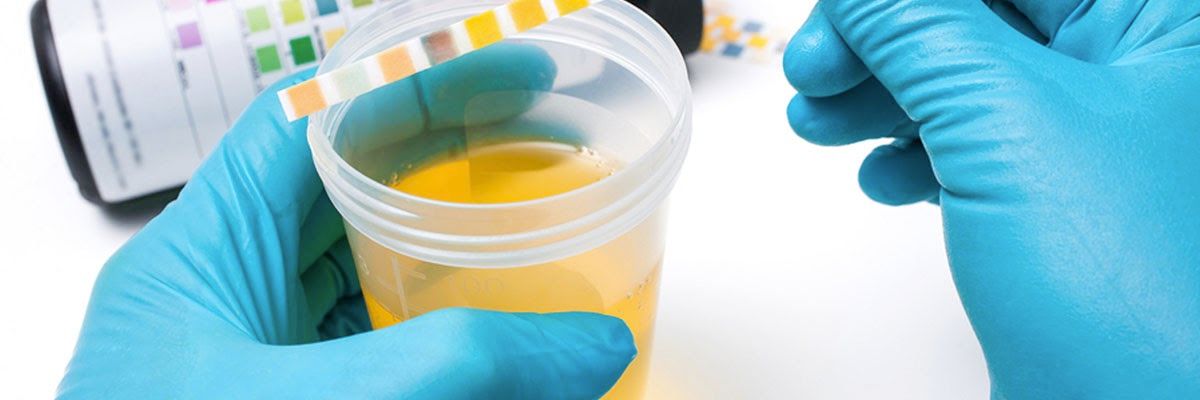 [Updated] How Long Does Cannabis Stay in Your System?