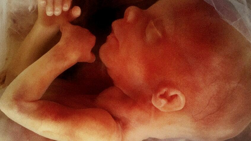 Número de abortos na Escócia atinge o segundo maior número da história - Jornal O São Paulo