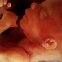 Aborto