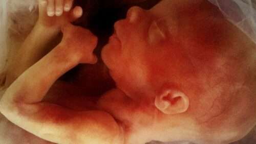 Aborto