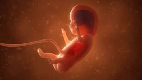 aborto